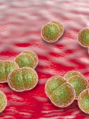 meningite-pneumococica_19115_l