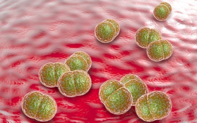 meningite-pneumococica_19115_l